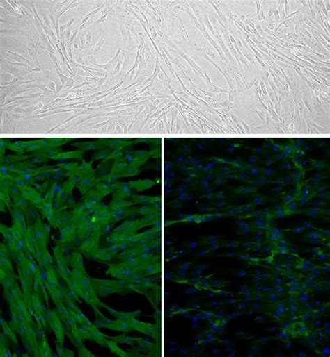 Canine Trabecular Meshwork Cells: CnTMC | Cell Applications