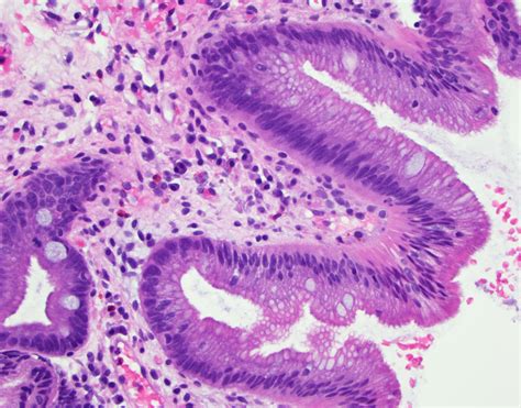 Esophagus Histology