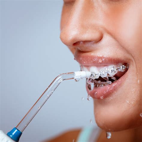 Brushing And Flossing With Braces - Boerne Orthodontics & Pediatric ...