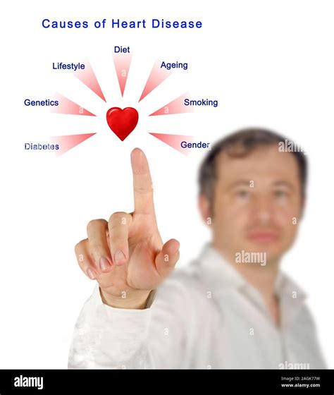 Causes of Heart Disease Stock Photo - Alamy