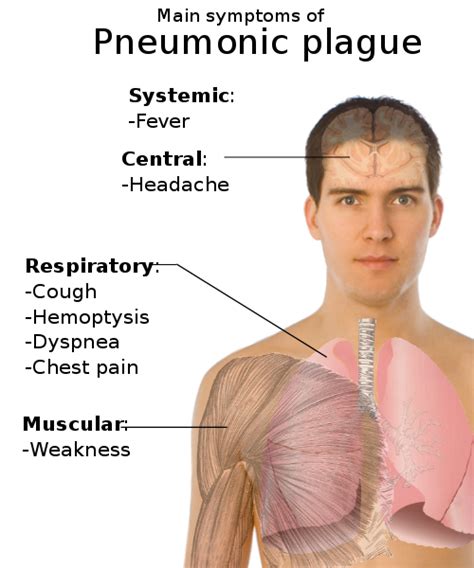 File:Symptoms of pneumonic plague.svg - Wikipedia