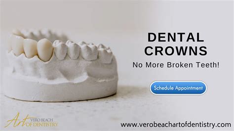 Natural Looking Bridge Tooth Replacement | by Vero Beach Art of ...