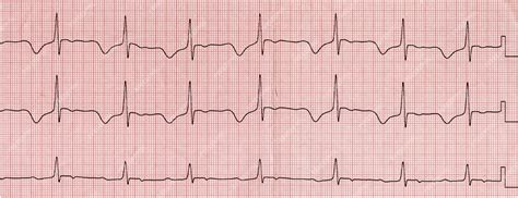 Premium Photo | Cardiogram