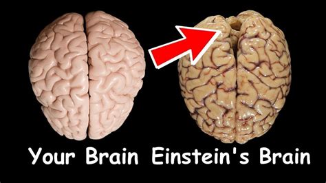 Your Brain vs Einstein's Brain? - YouTube