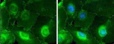 MCAM/CD146 Antibody (NBP2-15778): Novus Biologicals