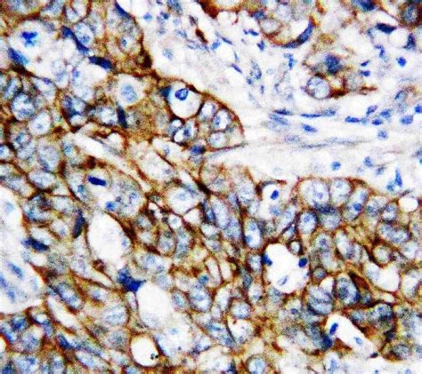 beta Catenin/CTNNB1 Antibody PA1212-1