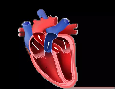 Right-Sided Heart Failure: Symptoms, Causes, and Treatment | myPHteam