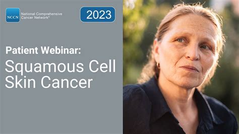 NCCN Patient Webinar: Squamous Cell Skin Cancer - YouTube
