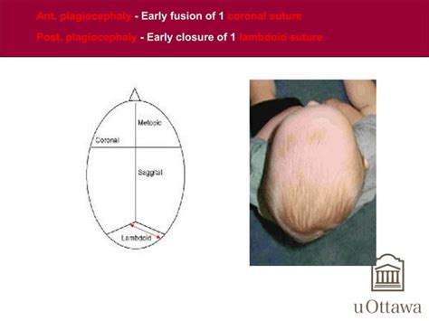 Craniofacial anomalies | PPT