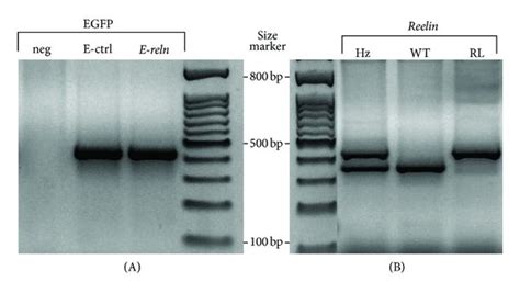 E-reeler model. (a) Agarose gel representative of EGFP and Reelin gene ...