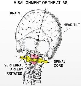 Modality - Upper Cervical Adjustment | Chiropractor in Austin, TX ...