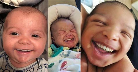 Photos of Babies with Grown-Up Teeth | PetaPixel