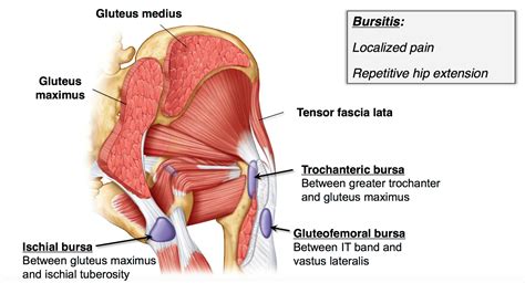 bursa of gluteus maximus - Google Search | Greater trochanter, Lower limb, Fascia lata