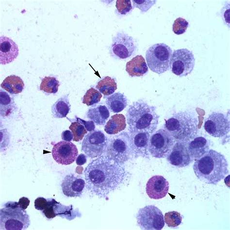 Figure 3: Bronchoalveolar lavage from a horse with skin lesions and coughing | eClinpath