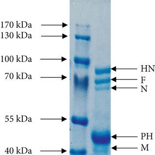 Coomassie brilliant blue-stained 8% acrylamide gel represents five... | Download Scientific Diagram