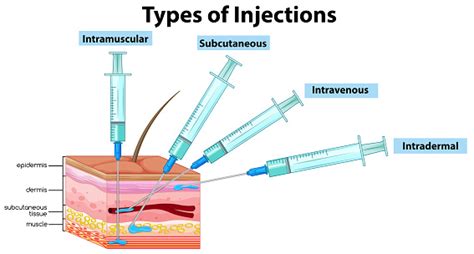 Types Of Injections On White Background Stock Illustration - Download ...