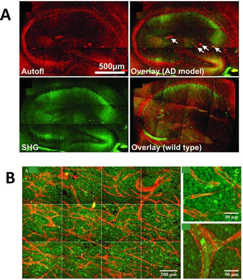 Second and third harmonic generation microscopy images in detection of... | Download Scientific ...