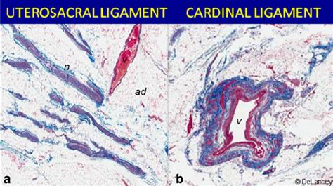 Histology after trichrome staining of biopsy specimen of the deep... | Download Scientific Diagram