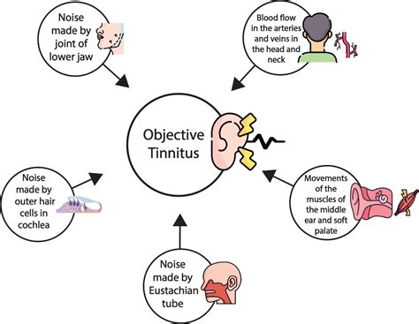 Tinnitus | Causes, Therapies and Solutions | Hashir Tinnitus Clinic