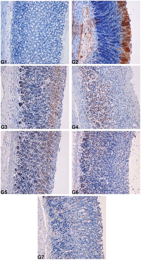 Immunohistochemical analysis of the expression of the BAX protein in... | Download Scientific ...