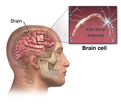 Evaluation of a First-Time Seizure | Johns Hopkins Medicine