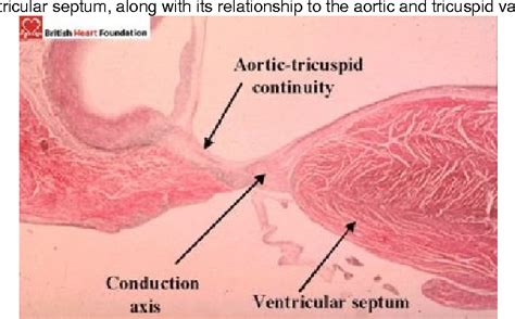 Interventricular Septum Histology