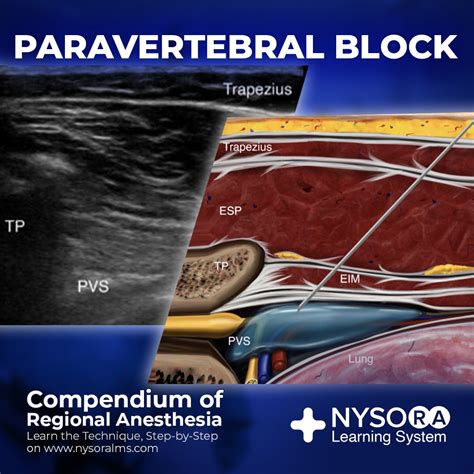 ⭐Learn how to... - NYSORA - Continuing Medical Education