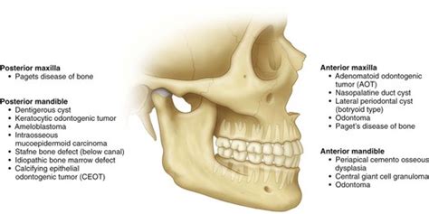 1: Oral and Maxillofacial Radiology | Pocket Dentistry