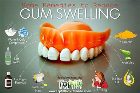 Home Remedies to Reduce Gum Swelling | Top 10 Home Remedies