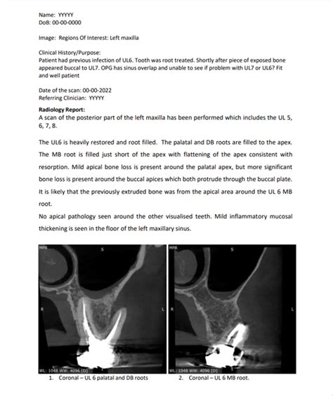 CBCT Scan Interpret - Fusion Radiology