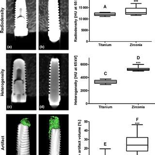 Imaging of zirconia and titanium implants. Magnetic resonance imaging ...