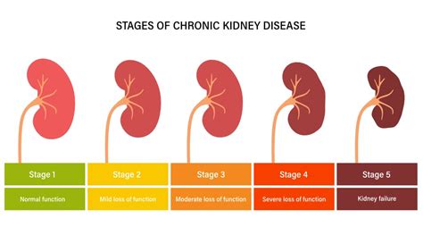 5 Causes and Risk Factors for Chronic Kidney Disease