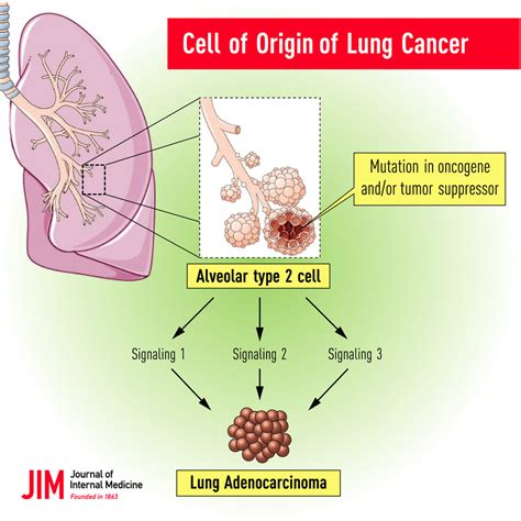 Lung Cancer Cells Vs Normal Cells