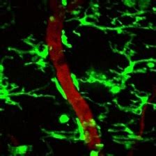 In Vivo Imaging of the Mouse Spinal Cord Using Two-photon Microscopy – Akassoglou Lab