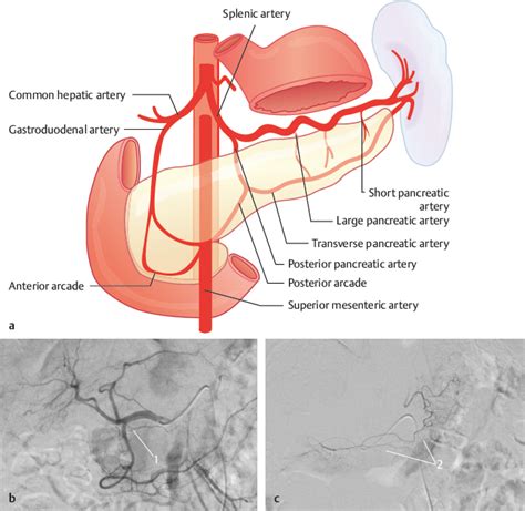 Pancreatic Arteries | Radiology Key