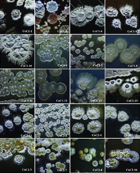 Actinomycetes Morphology