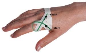 Sprained Knuckle Taping – Physical Sports First Aid Blog