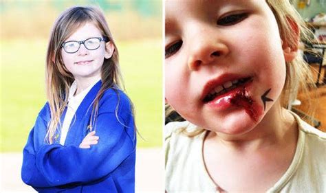 Meet Olivia Farnsworth, a 7-year-old girl with a rare condition known as Chromosome 6 Deletion ...