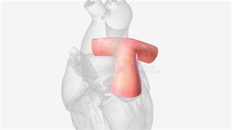 Pulmonary Artery is an Artery in the Pulmonary Circulation that Carries Deoxygenated Blood Stock ...