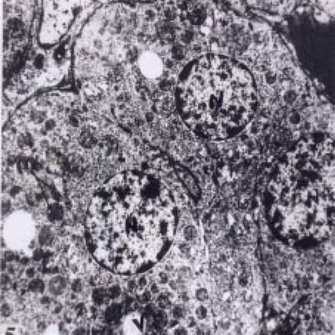 Zona fasciculata cells of heroin treated rat on day 30 showing... | Download Scientific Diagram