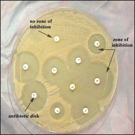 Antibiotic Sensitivity Test by Kirby-Bauer method | Medical Laboratories