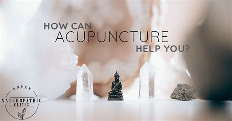 How Can Acupuncture Help You? - Annex Naturopathic Clinic