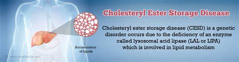 Cholesteryl Ester Storage Disease - Causes, Symptoms, Diagnosis ...