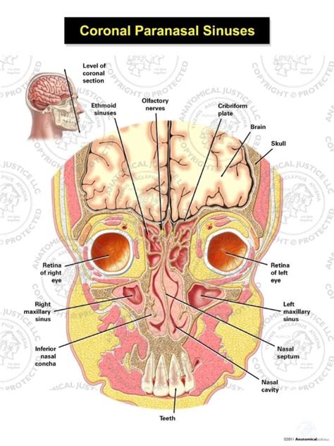 Coronal Paranasal Sinuses