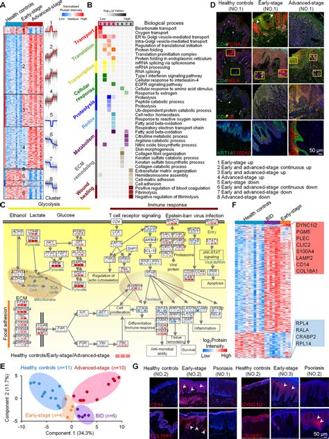 Proteomic identification of diagnostic biomarkers of early‐stage... | Download Scientific Diagram