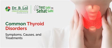 Common Thyroid Disorders: Symptoms, Causes, and Treatments