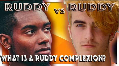 What is a Ruddy Complexion? (2021) - YouTube