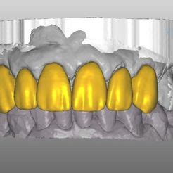 Dental Crown best STL files for 3D printing・Cults