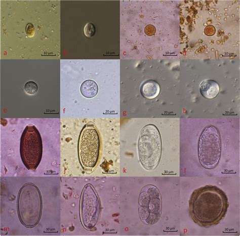 Parasite In Stool Pictures Human