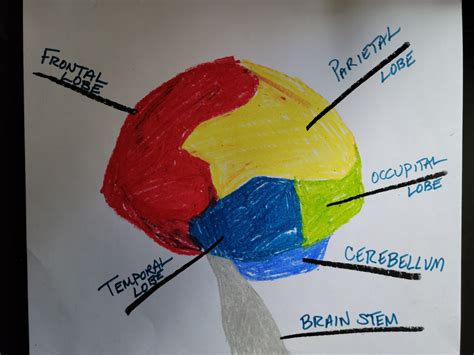 The Four Major Types of Dementia and the Parts of the Brain Affected ...